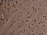 RGS14 Antibody in Immunohistochemistry (Paraffin) (IHC (P))