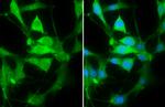 PHD2 Antibody in Immunocytochemistry (ICC/IF)