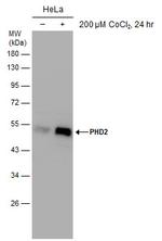 PHD2 Antibody in Western Blot (WB)