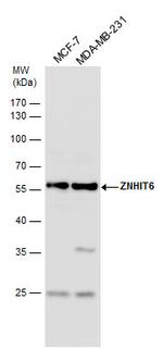 ZNHIT6 Antibody in Western Blot (WB)