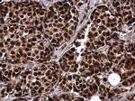 RIF1 Antibody in Immunohistochemistry (Paraffin) (IHC (P))