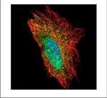 DCP1A Antibody in Immunocytochemistry (ICC/IF)