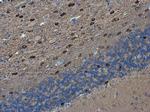 PEX5L Antibody in Immunohistochemistry (Paraffin) (IHC (P))