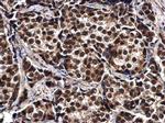 ELAC2 Antibody in Immunohistochemistry (Paraffin) (IHC (P))