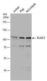 ELAC2 Antibody in Western Blot (WB)