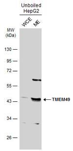 VMP1 Antibody in Western Blot (WB)