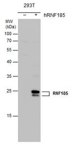 RNF185 Antibody in Western Blot (WB)