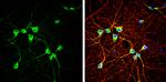 NRG1 Antibody in Immunocytochemistry (ICC/IF)