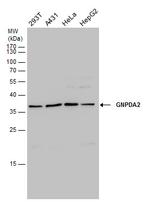 GNPDA2 Antibody in Western Blot (WB)