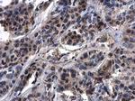 ASXL1 Antibody in Immunohistochemistry (Paraffin) (IHC (P))