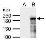 ASXL1 Antibody in Western Blot (WB)