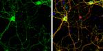 SHANK2 Antibody in Immunocytochemistry (ICC/IF)