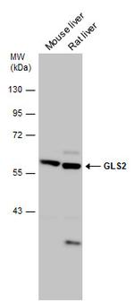 GLS2 Antibody in Western Blot (WB)