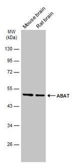 ABAT Antibody in Western Blot (WB)