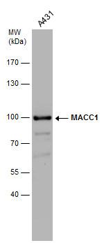 MACC1 Antibody in Western Blot (WB)