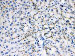 BSEP Antibody in Immunohistochemistry (Paraffin) (IHC (P))