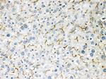 BSEP Antibody in Immunohistochemistry (Paraffin) (IHC (P))