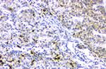 ABCB4 Antibody in Immunohistochemistry (Paraffin) (IHC (P))