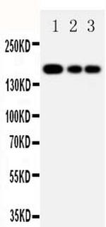 MRP1 Antibody in Western Blot (WB)