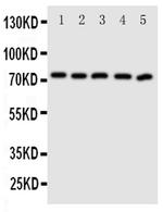 ABCG5 Antibody in Western Blot (WB)