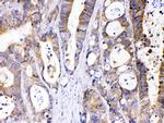 ABHD5 Antibody in Immunohistochemistry (Paraffin) (IHC (P))