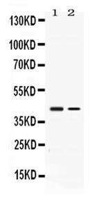 ABHD5 Antibody in Western Blot (WB)