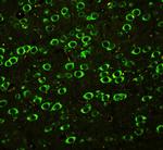 ABI1 Antibody in Immunohistochemistry (Paraffin) (IHC (P))