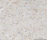 ABI1 Antibody in Immunohistochemistry (Paraffin) (IHC (P))