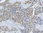 ABL2 Antibody in Immunohistochemistry (Paraffin) (IHC (P))