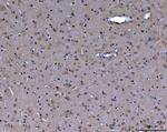 ABL2 Antibody in Immunohistochemistry (Paraffin) (IHC (P))