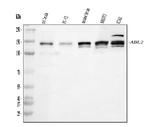 ABL2 Antibody in Western Blot (WB)