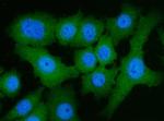 ATP Citrate Lyase Antibody in Immunocytochemistry (ICC/IF)