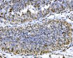 ATP Citrate Lyase Antibody in Immunohistochemistry (Paraffin) (IHC (P))