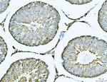 ATP Citrate Lyase Antibody in Immunohistochemistry (Paraffin) (IHC (P))