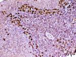 Adenosine Deaminase Antibody in Immunohistochemistry (Paraffin) (IHC (P))