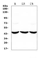 Adenosine Deaminase Antibody in Western Blot (WB)