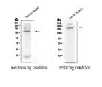 ADAMTS13 Antibody in Western Blot (WB)