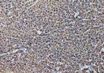 Alcohol Dehydrogenase 1A Antibody in Immunohistochemistry (Paraffin) (IHC (P))