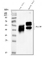 RAGE Antibody in Western Blot (WB)