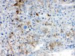 AKR1B10 Antibody in Immunohistochemistry (Paraffin) (IHC (P))