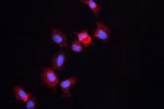 ALDH1A3 Antibody in Immunocytochemistry (ICC/IF)