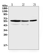 ALDH1A3 Antibody in Western Blot (WB)