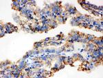 ALDH2 Antibody in Immunohistochemistry (Paraffin) (IHC (P))