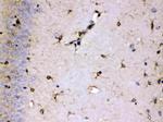 ALDH7A1 Antibody in Immunohistochemistry (Paraffin) (IHC (P))