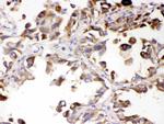 ALDH7A1 Antibody in Immunohistochemistry (Paraffin) (IHC (P))