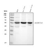 ALDH7A1 Antibody in Western Blot (WB)