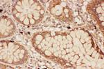 ALOX15 Antibody in Immunohistochemistry (Paraffin) (IHC (P))