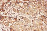 ALOX15 Antibody in Immunohistochemistry (Paraffin) (IHC (P))