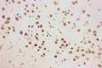 ALOX5 Antibody in Immunohistochemistry (Paraffin) (IHC (P))