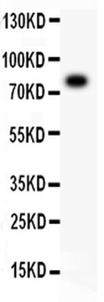 ALOX5 Antibody in Western Blot (WB)